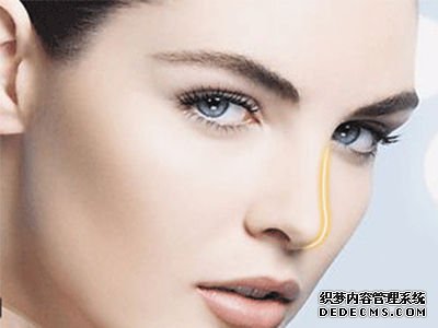 肋软骨隆鼻手术