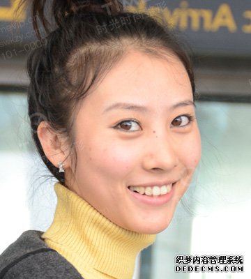 地包天矫正的过程大概要经过哪些步骤
