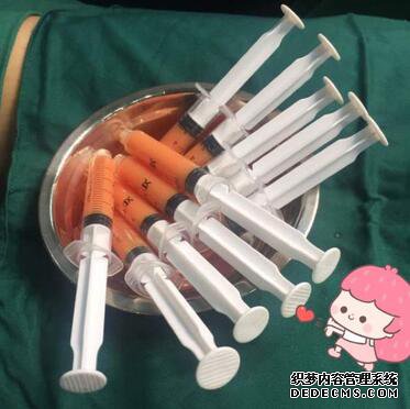 上海余天成自体脂肪隆胸70天恢复经历